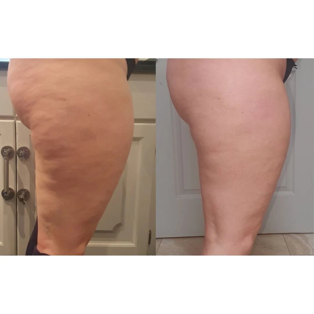 Nordic Fit™ Skulptera 1.0 - Nordic Fit