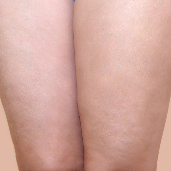 Hudens utseende upplevs förbättrat och celluliter mindre synliga med regelbunden användning. – efter